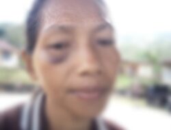 KDRT, Seorang Istri di Cibal Diduga Dianiaya Suami hingga Pingsan.